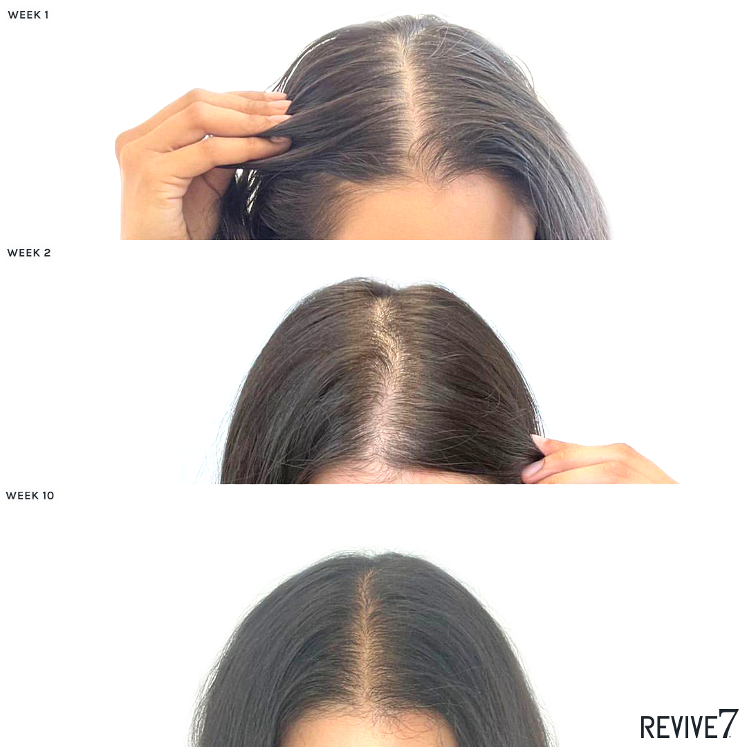 Revive7 Revitalizing Hair Treatment-Hair Loss Treatments LASHFOREVER CANADA