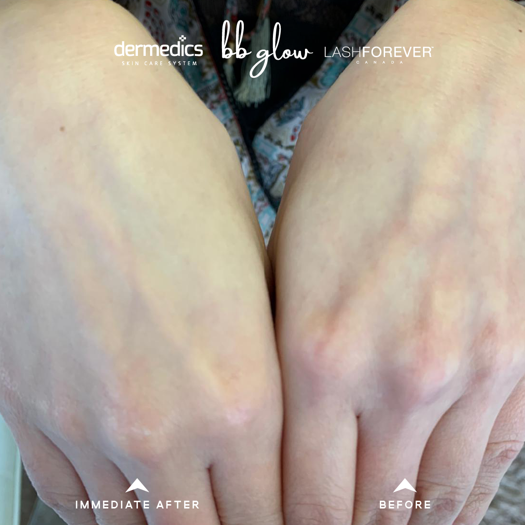 Dermedics YOUTH EXPERT™ WHITEseries Serum White Deluxe-Dermedics LASHFOREVER CANADA